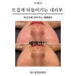 프레야