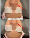 아뜨레