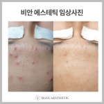 비안에스테틱