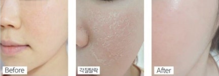 마이스킨테라피