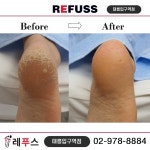 레푸스 태릉입구역점