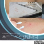 투모로우 스킨엔바디