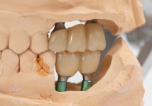 지플란트 치과기공소