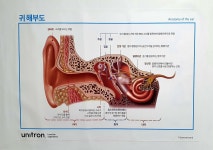 유니트론보청기 대구영대병원센터