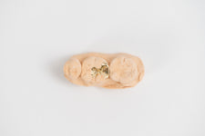 지플란트 치과기공소