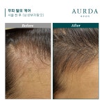 아우르다