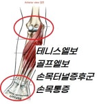 바른척추운동센터.재활운동.재활pt.체형교정