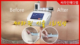 모블링스킨앤바디왁싱