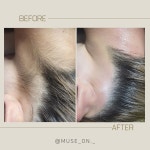 뮤즈온뷰티 여성전용왁싱 청라본점