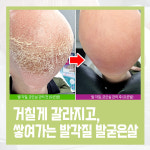 레푸스 칠곡점