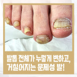 레푸스 칠곡점