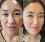 인셀덤 B&B목포대리점