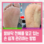 레푸스 칠곡점
