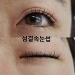 섬결속눈썹