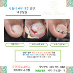 네일그리고