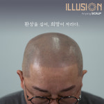 일루젼스칼프 안양