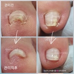 어바웃풋 AboutFoot