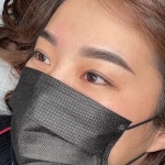 보민스킨