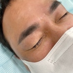 보민스킨