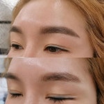 보민스킨