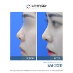 뉴원성형외과의원
