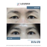 뉴원성형외과의원