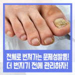 레푸스 칠곡점