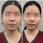 이신에스테틱 부산하단점