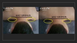 채움에스테틱