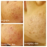 최프로스킨앤바디