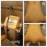 최프로스킨앤바디