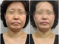 이신에스테틱 부산하단점