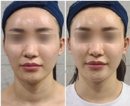 이신에스테틱 부산하단점