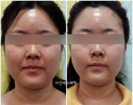 이신에스테틱 부산하단점