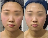 이신에스테틱 부산하단점