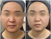 이신에스테틱 부산하단점