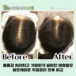 탈모케어존 대전둔산점