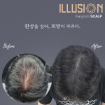 일루젼스칼프 제이든