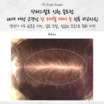 닥터스칼프 인천송도점