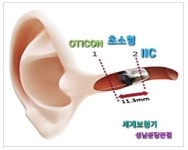 세계보청기 성남분당본점