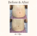 은블리 전주송천점