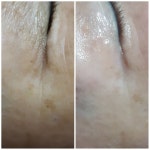 지에프코스메틱예쁜피부연구소 수원1호점