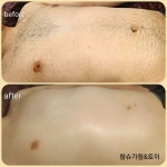 참슈가링왁싱