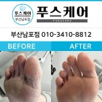 푸스케어글림네일 | 푸스케어 남포점 글림네일