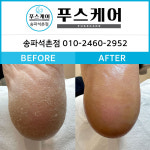 푸스케어 송파석촌점