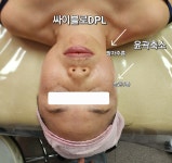 히든스파in미휴