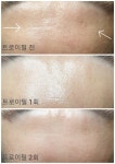 히든스파in미휴