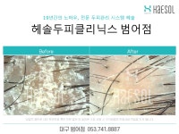 헤솔두피클리닉스 대구범어점