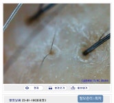 SUN 스칼프 크리닉