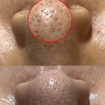 하베레피부전문센터